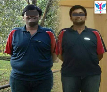 Weight Loss Before After 2